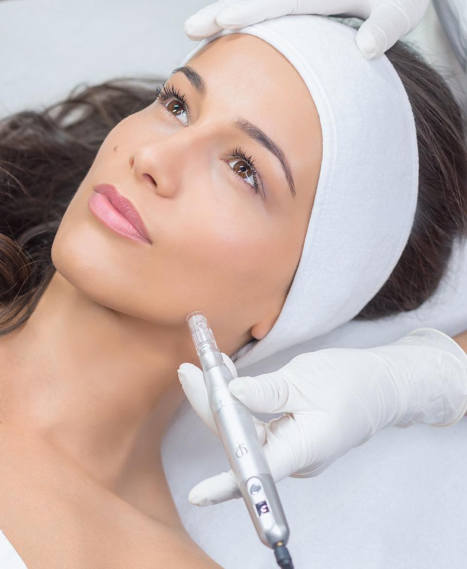 PhiBright MicroNeedling (Individual)